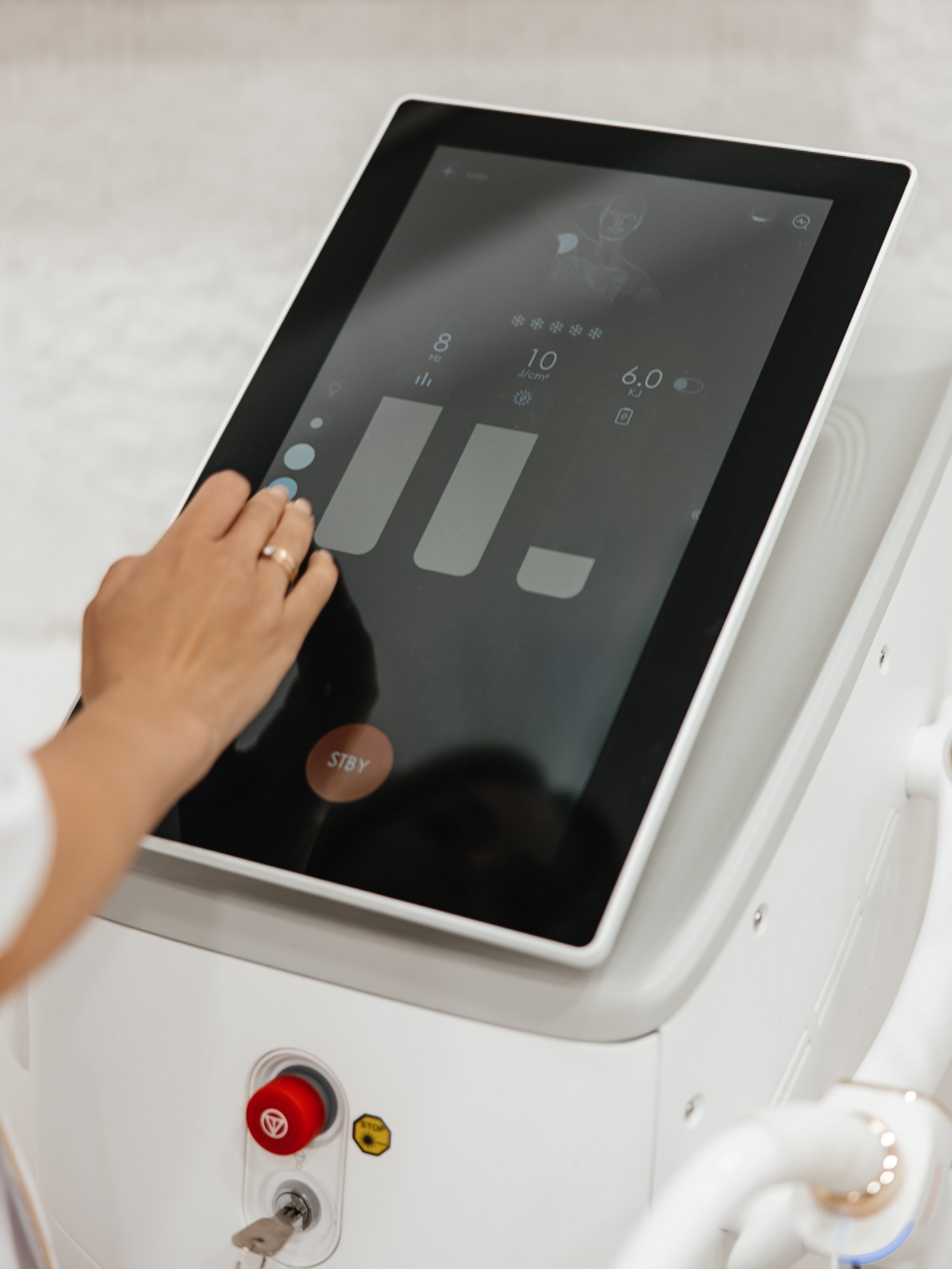 Epilare laser — echipament